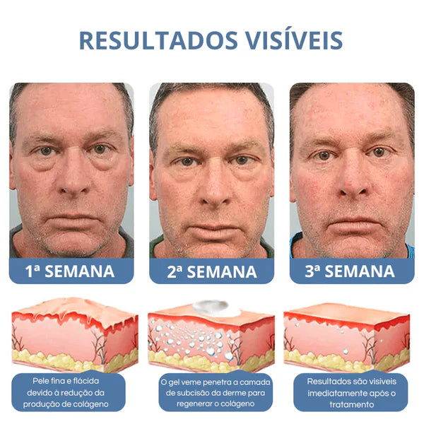 Creme Veze Anti Rugas e Olheiras